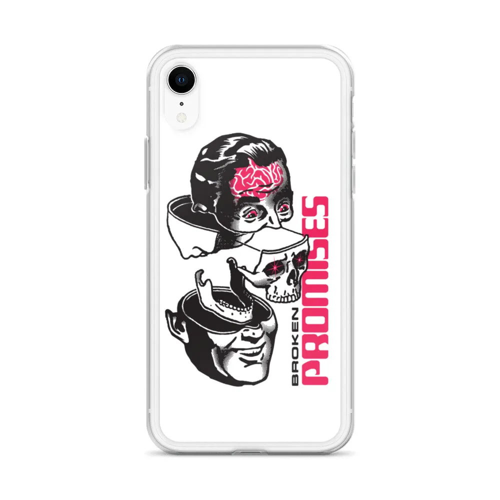 Brain Surgery iPhone Case