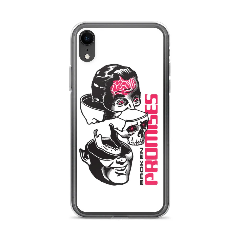 Brain Surgery iPhone Case