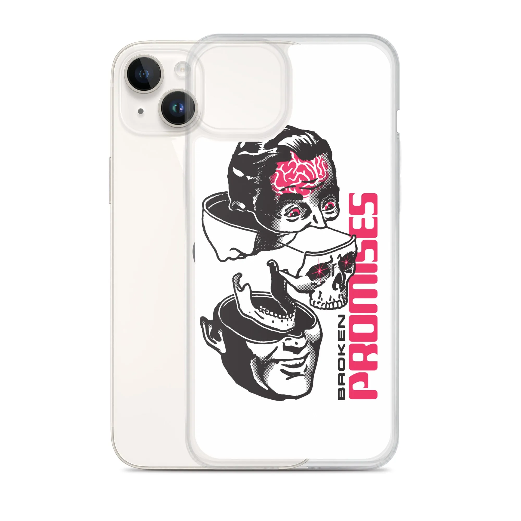 Brain Surgery iPhone Case