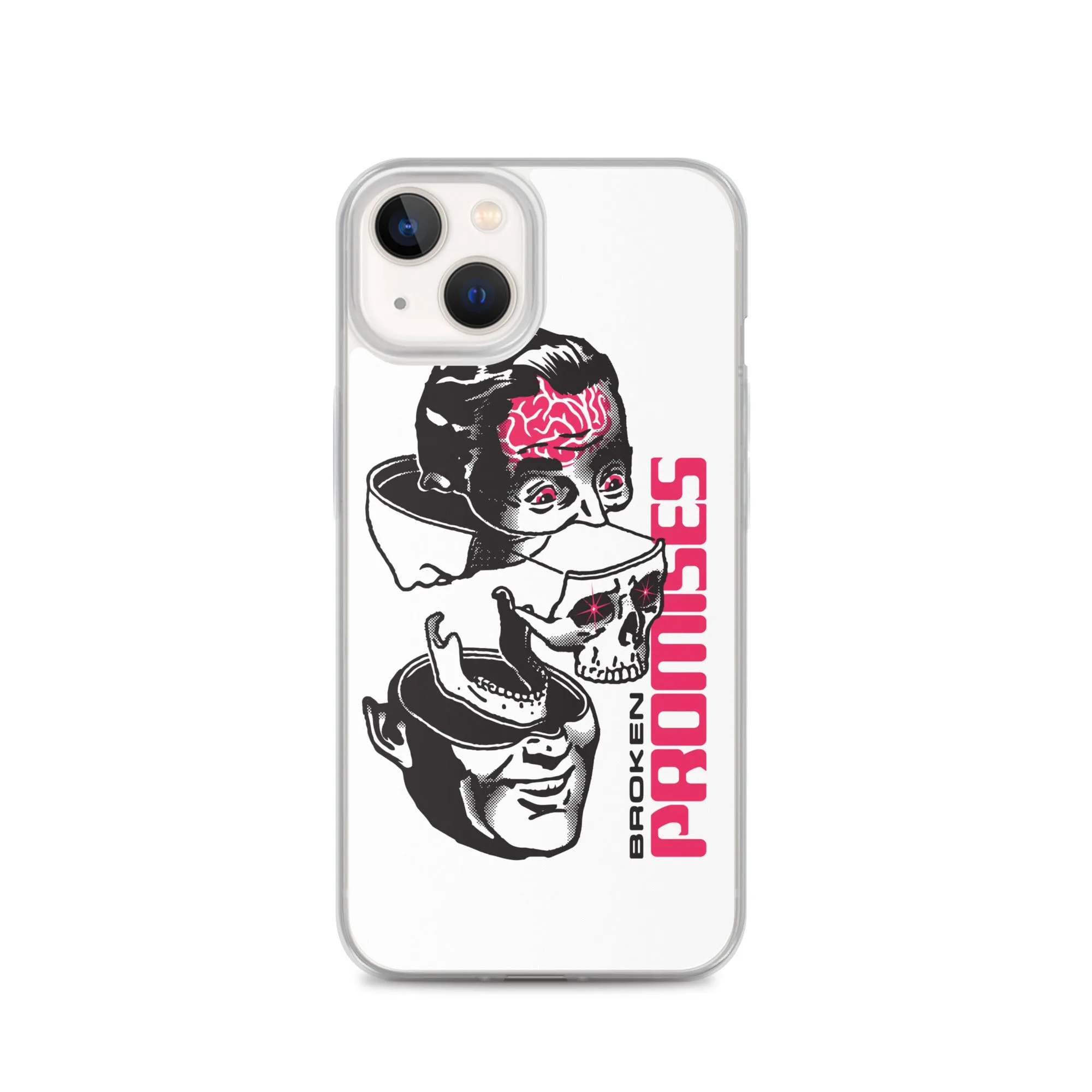 Brain Surgery iPhone Case