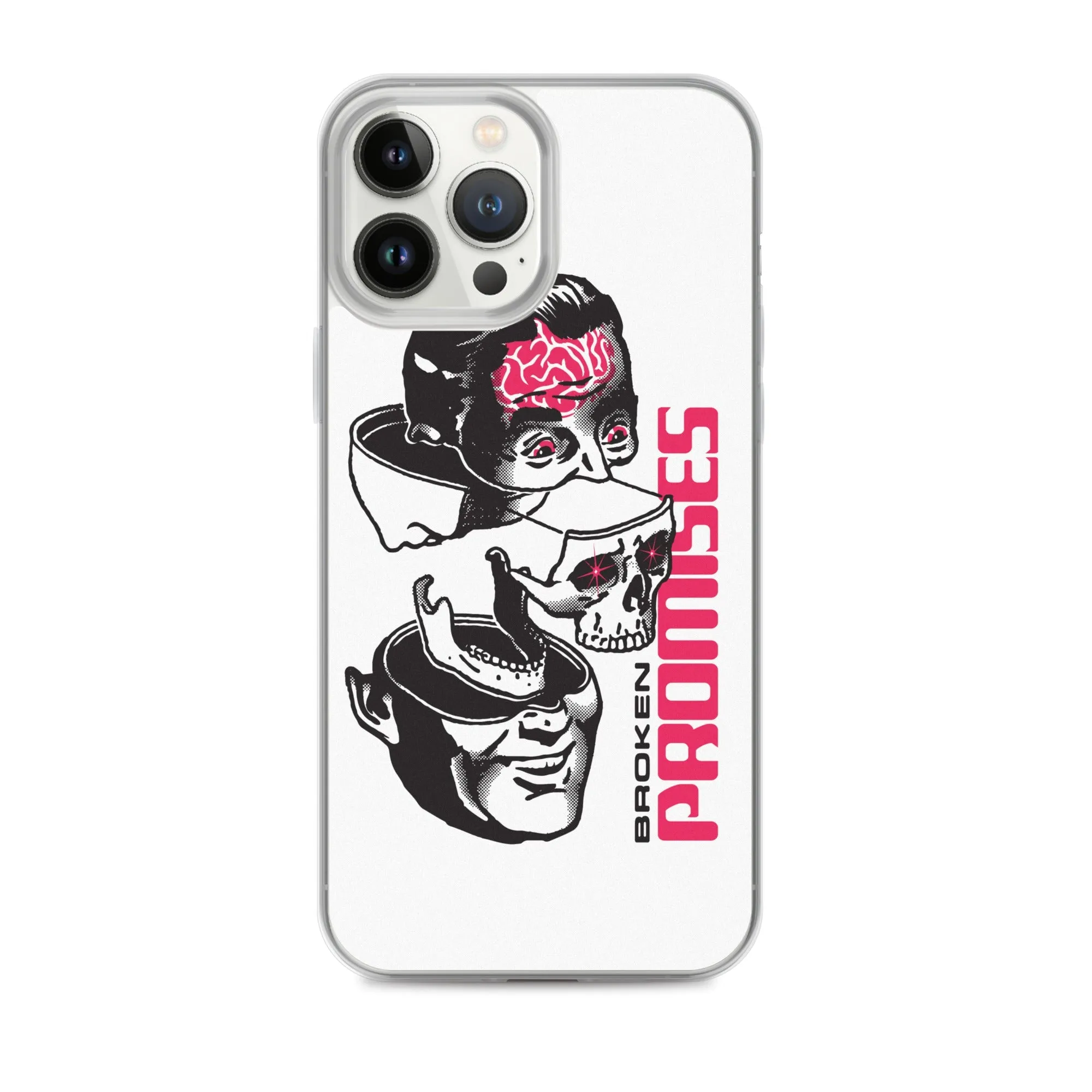 Brain Surgery iPhone Case