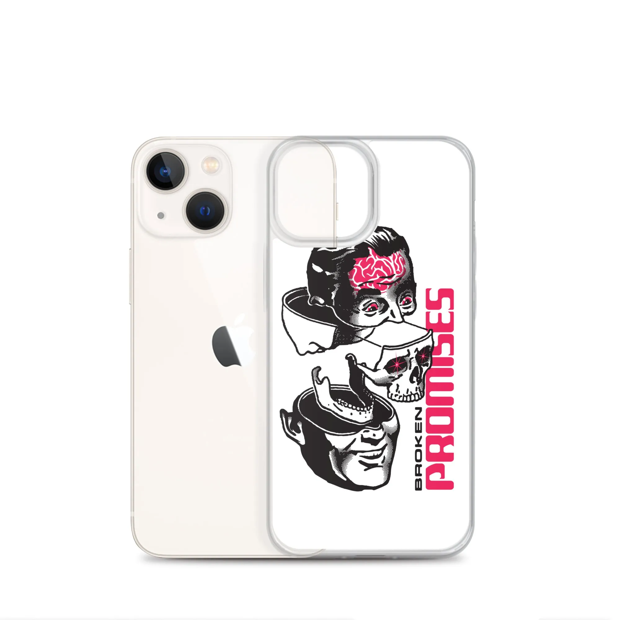 Brain Surgery iPhone Case