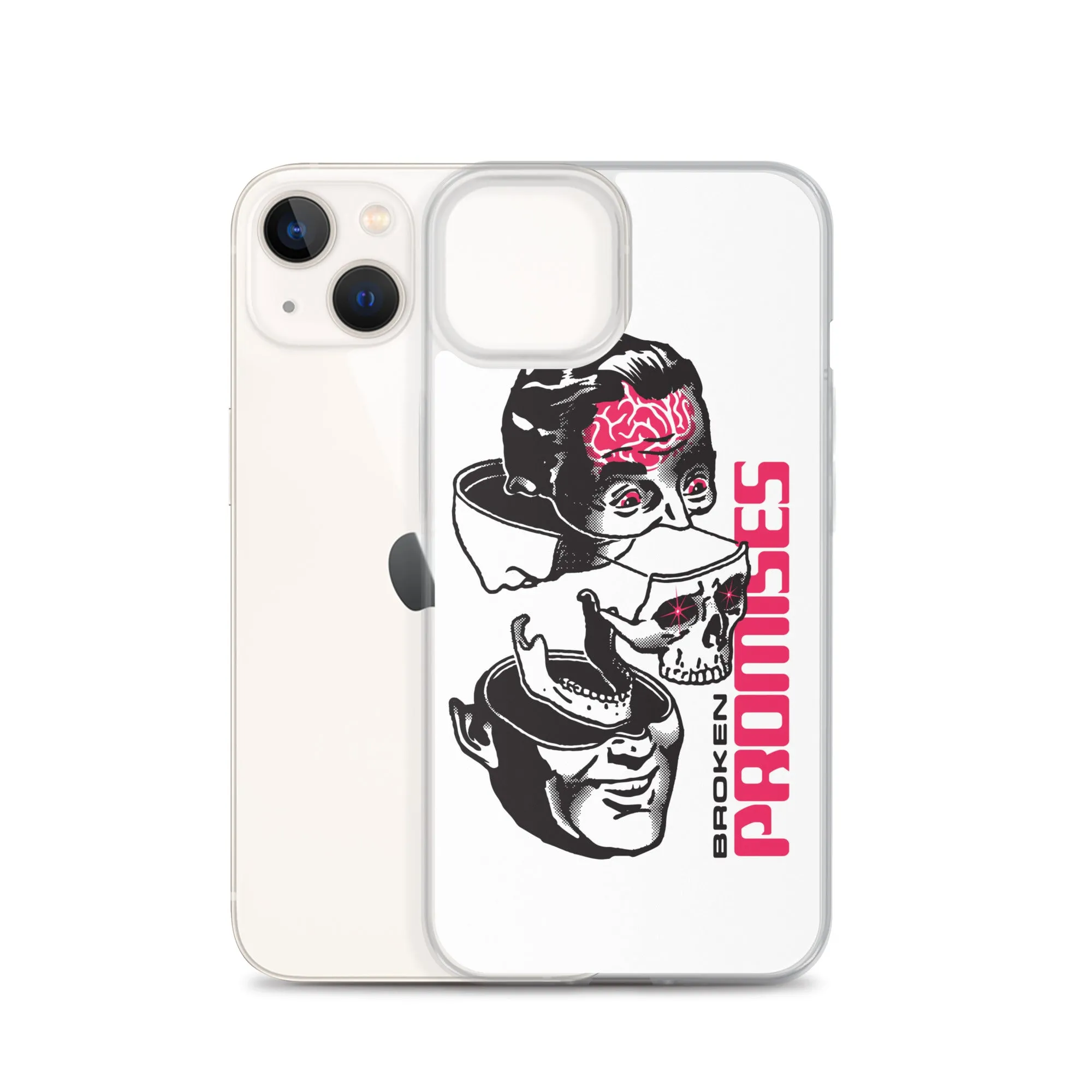 Brain Surgery iPhone Case