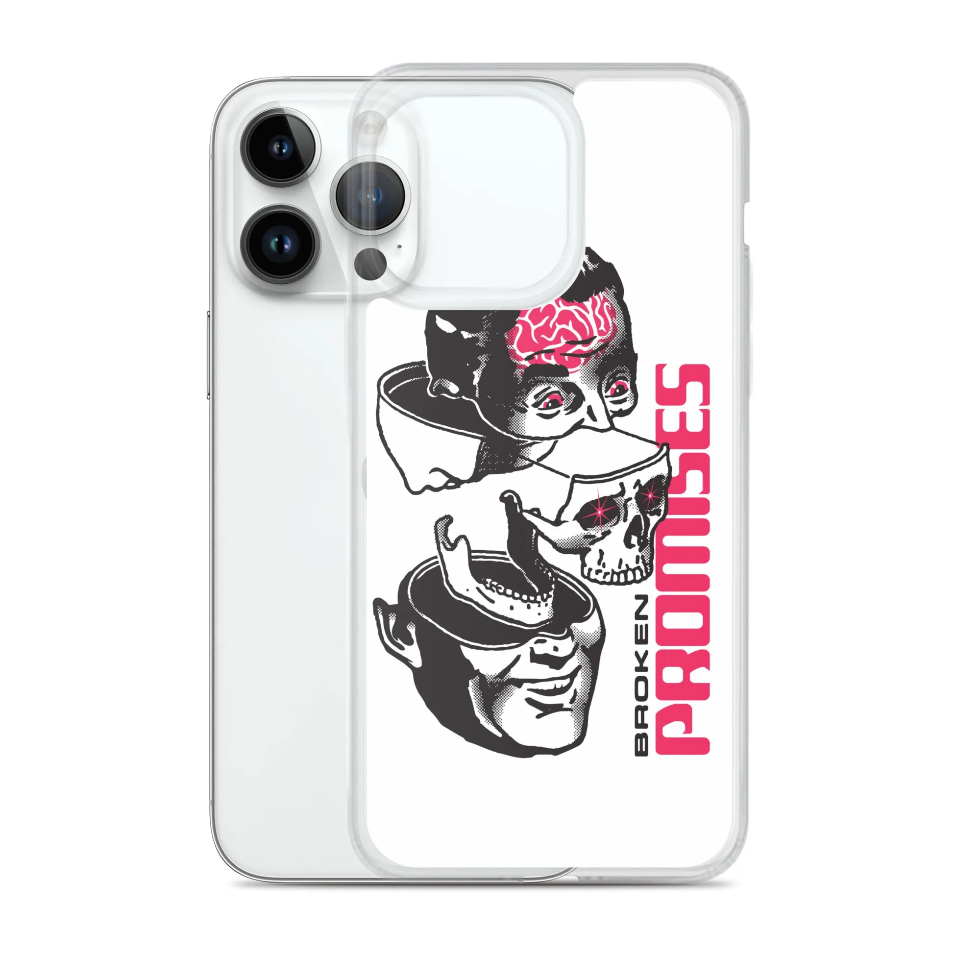 Brain Surgery iPhone Case