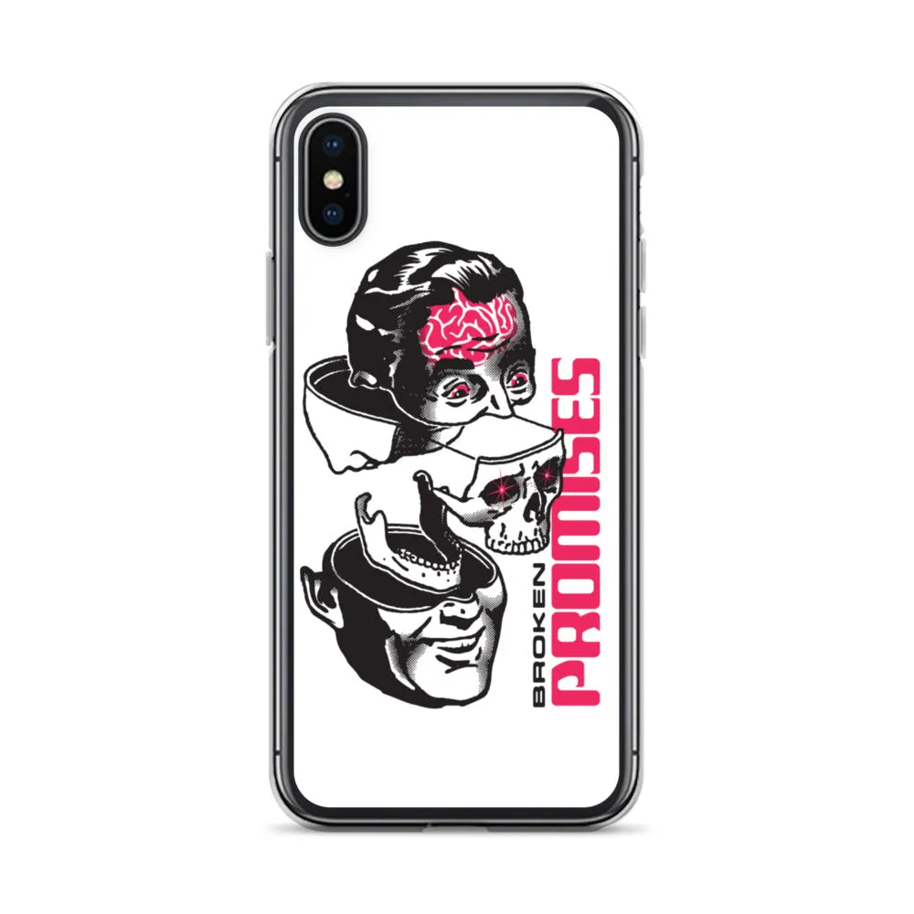 Brain Surgery iPhone Case