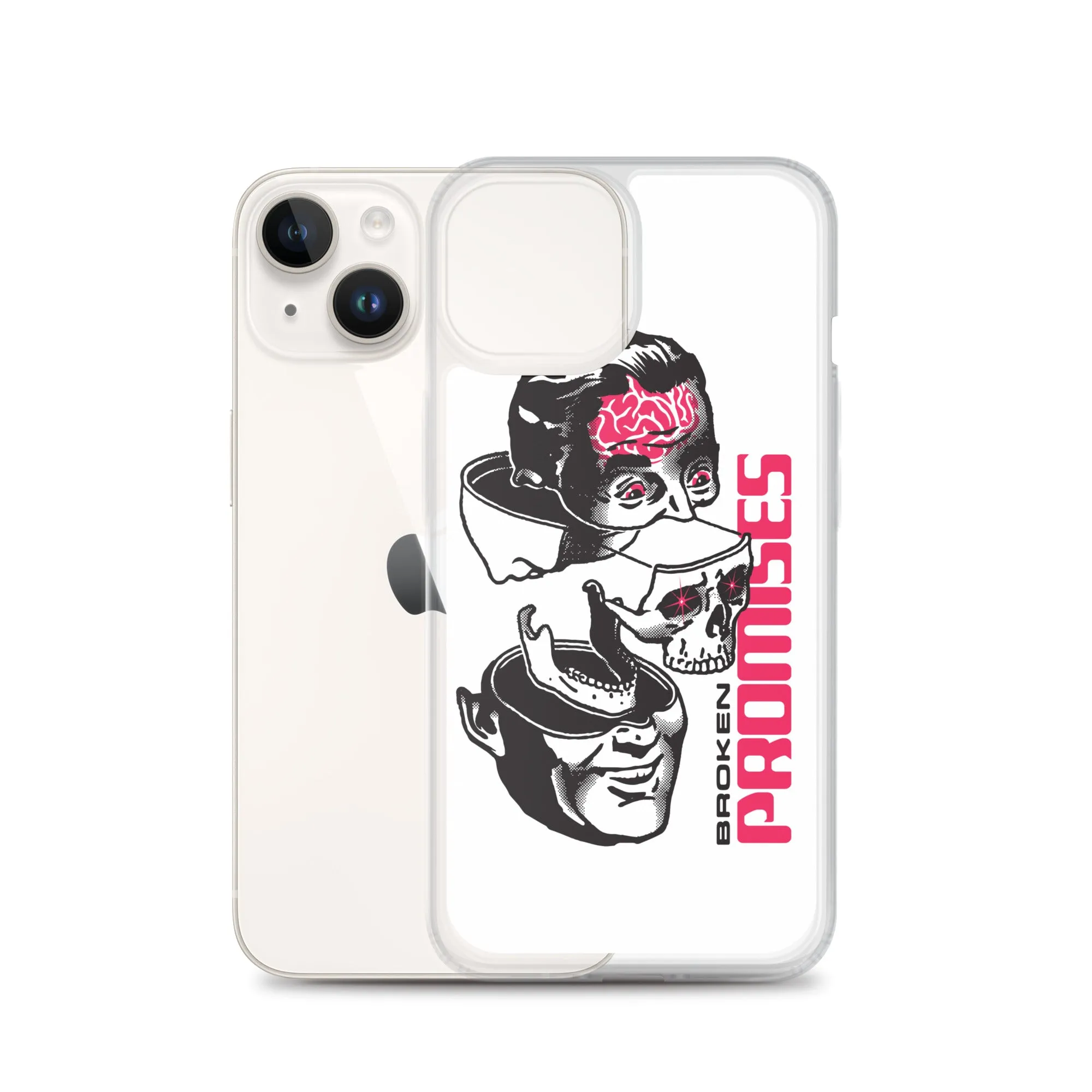 Brain Surgery iPhone Case