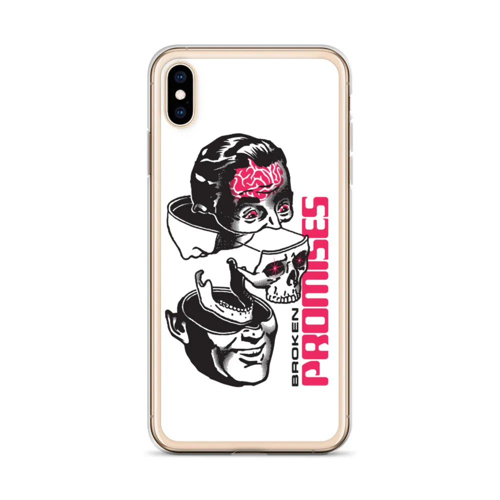 Brain Surgery iPhone Case