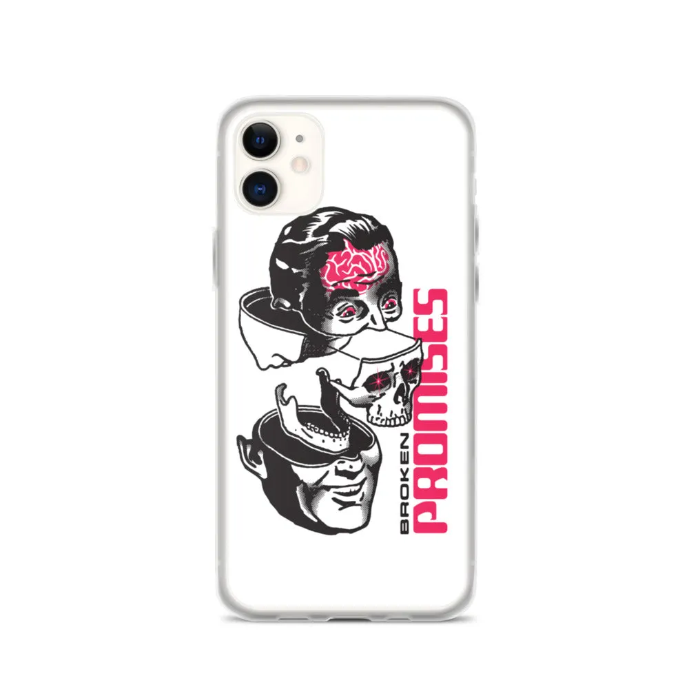 Brain Surgery iPhone Case