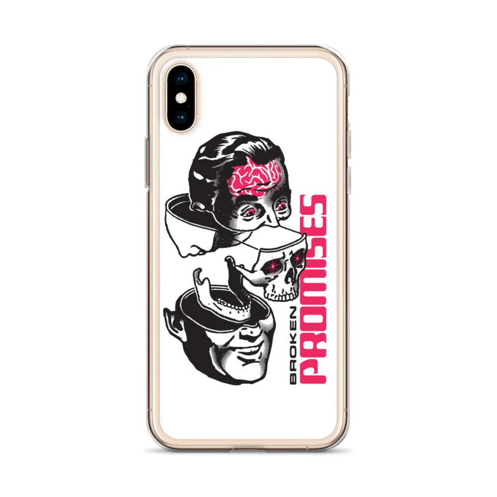 Brain Surgery iPhone Case