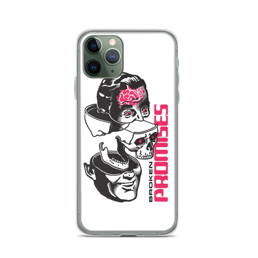 Brain Surgery iPhone Case