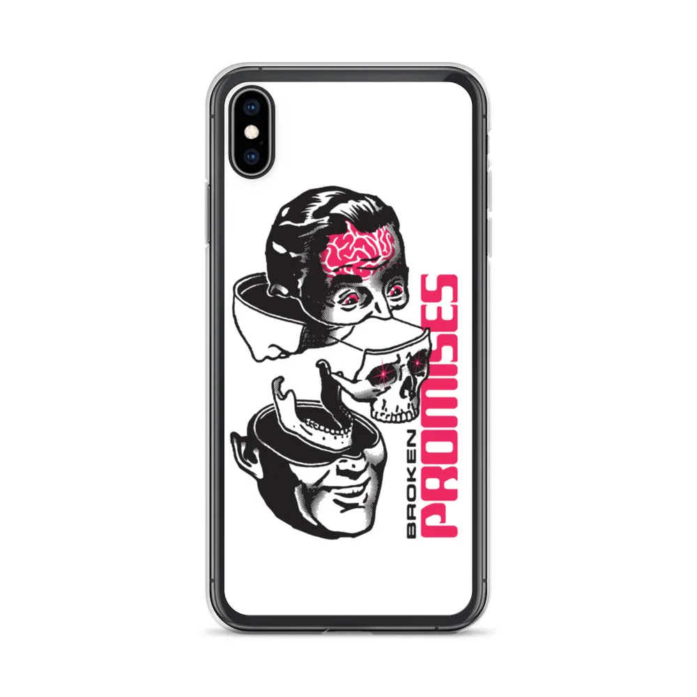 Brain Surgery iPhone Case