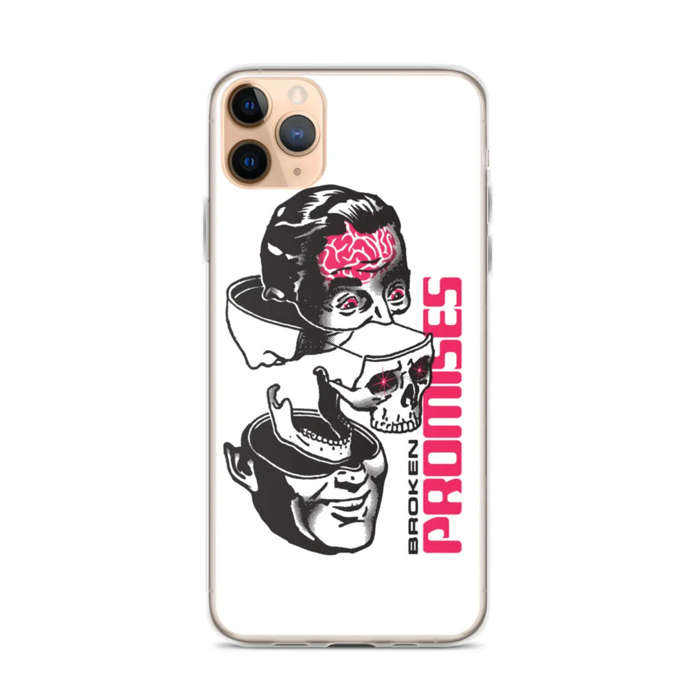 Brain Surgery iPhone Case