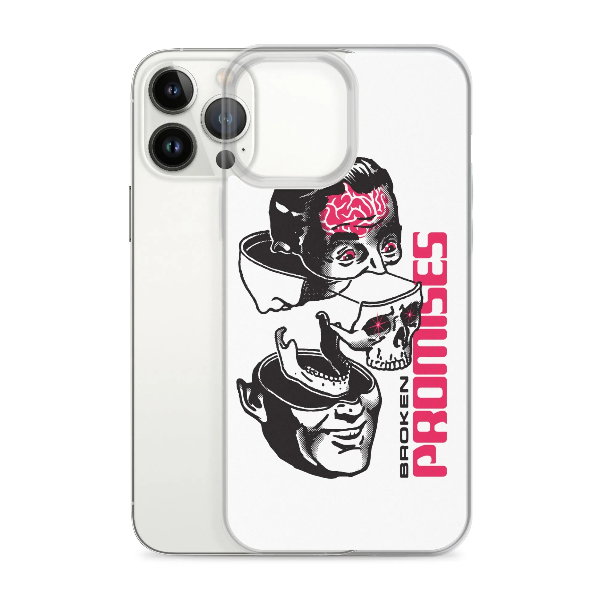 Brain Surgery iPhone Case