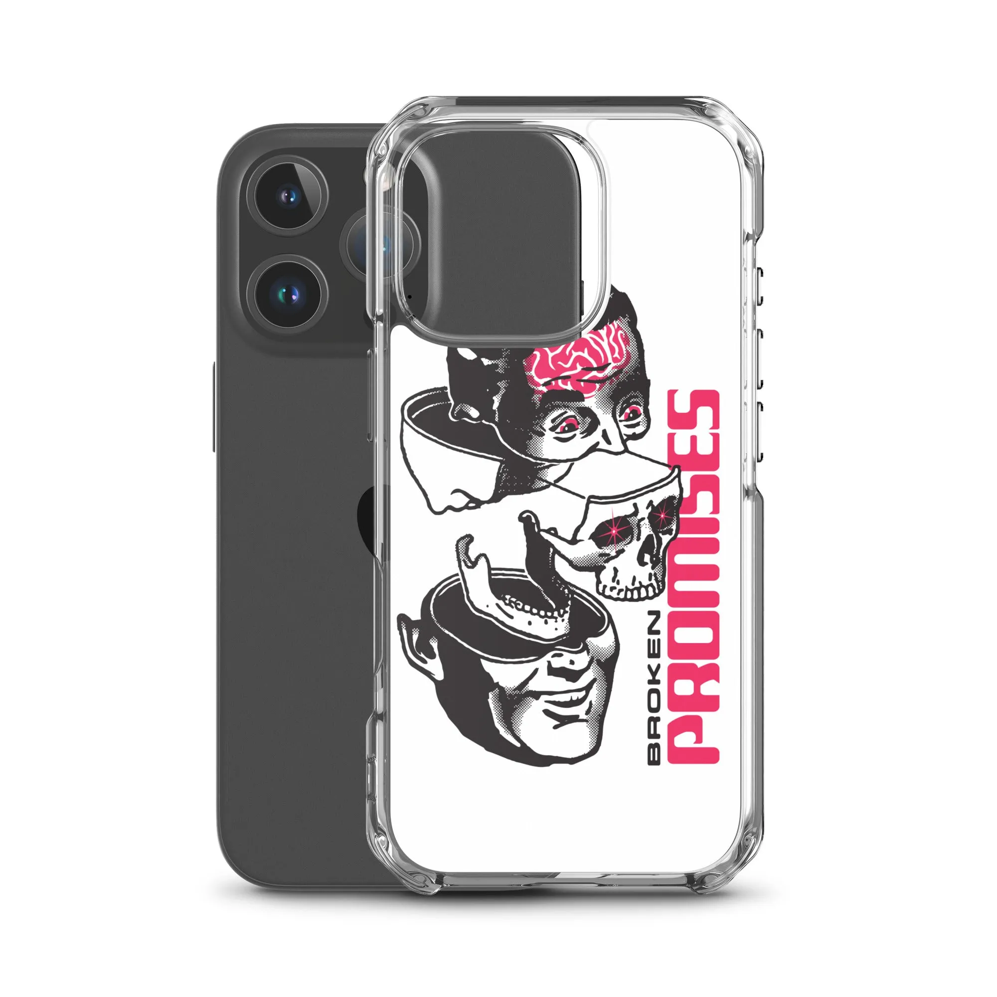 Brain Surgery iPhone Case