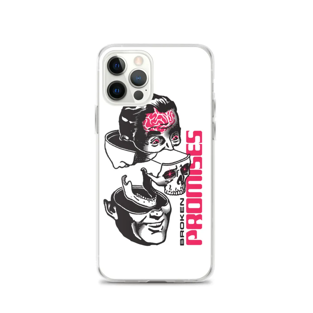 Brain Surgery iPhone Case