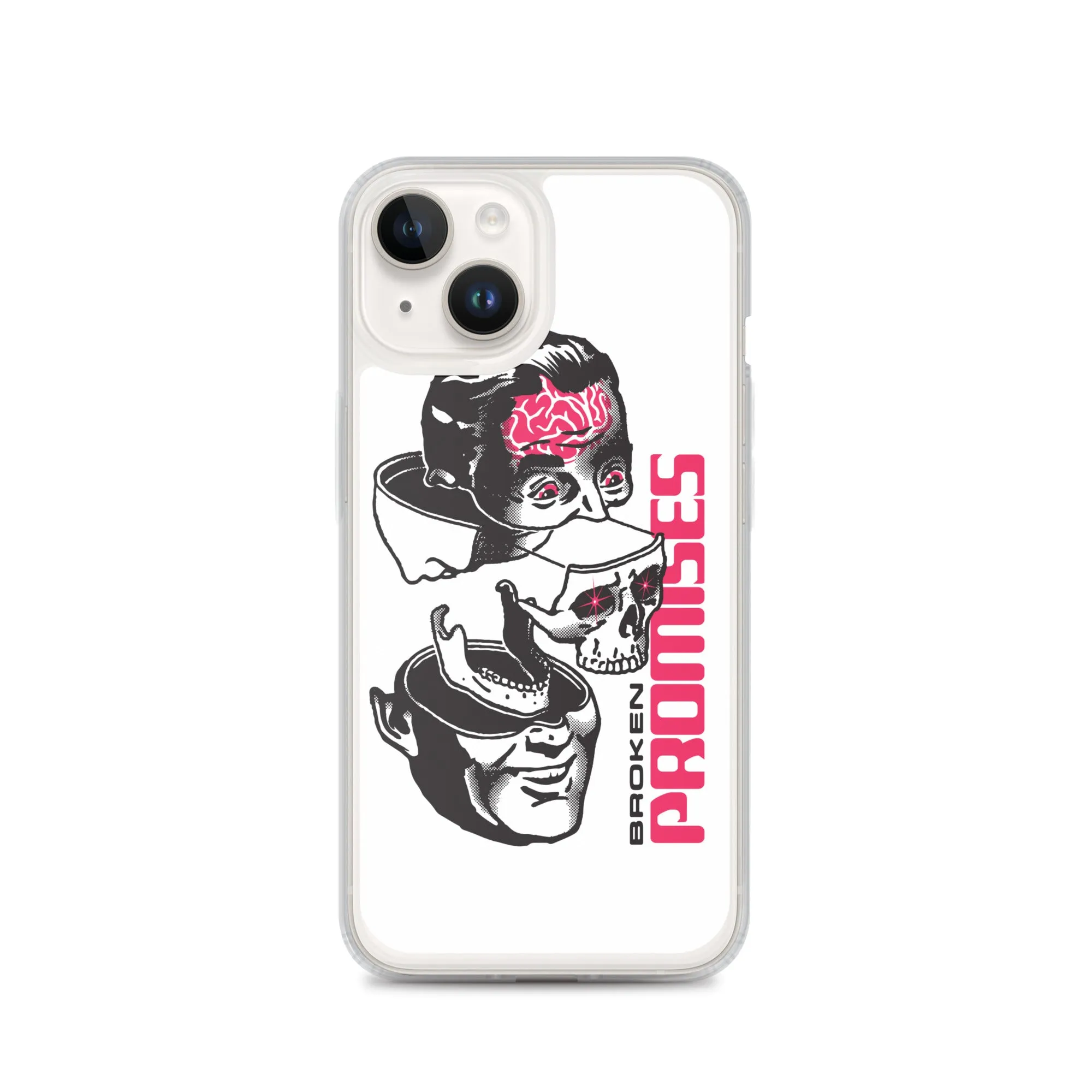 Brain Surgery iPhone Case