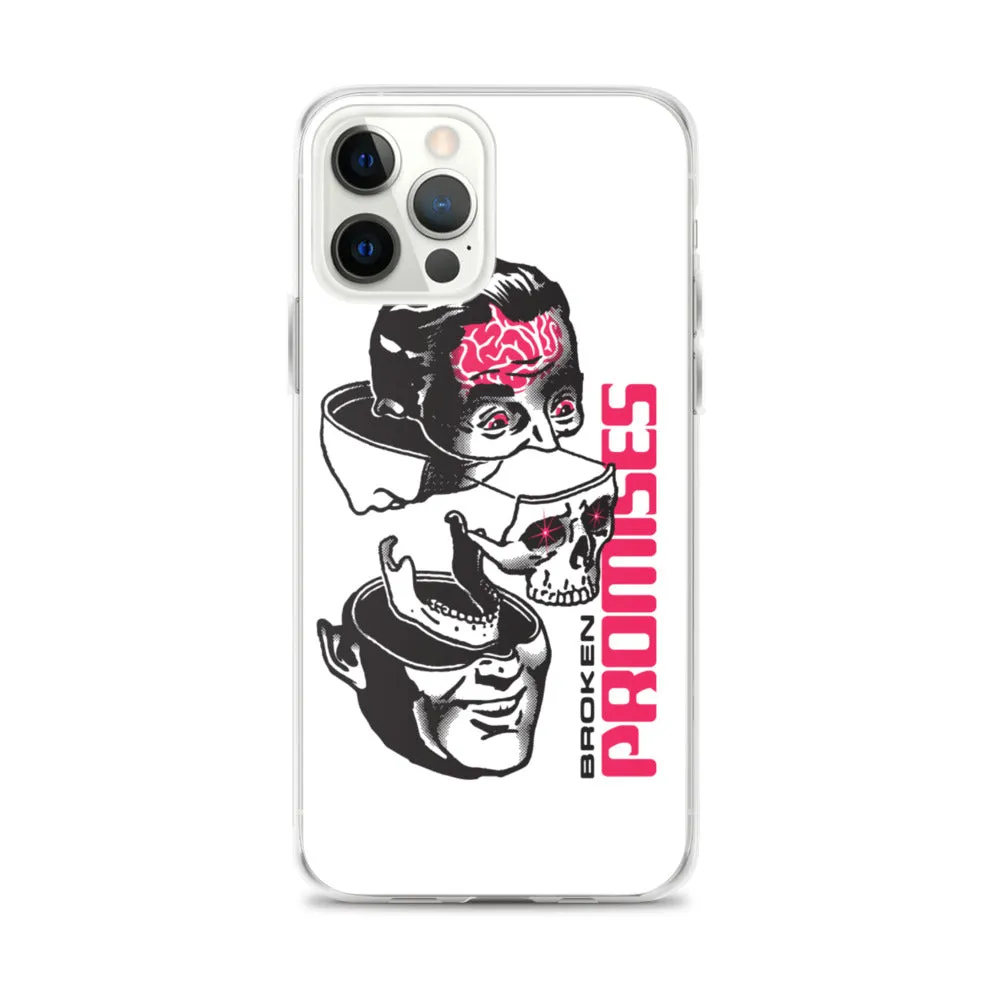 Brain Surgery iPhone Case