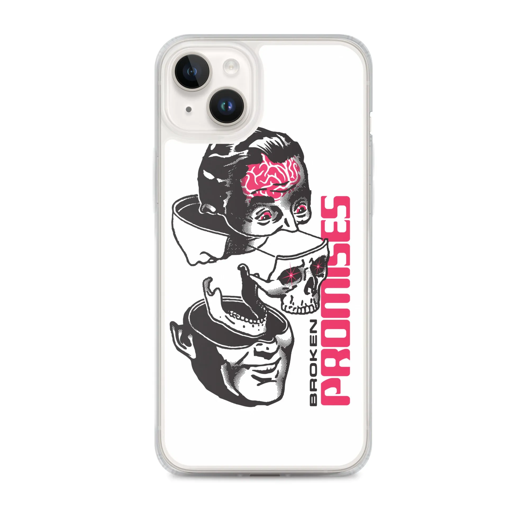 Brain Surgery iPhone Case