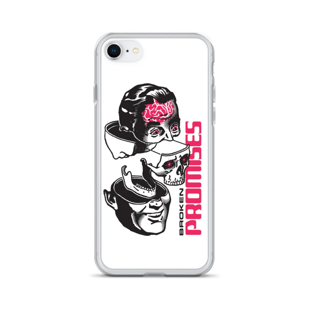 Brain Surgery iPhone Case